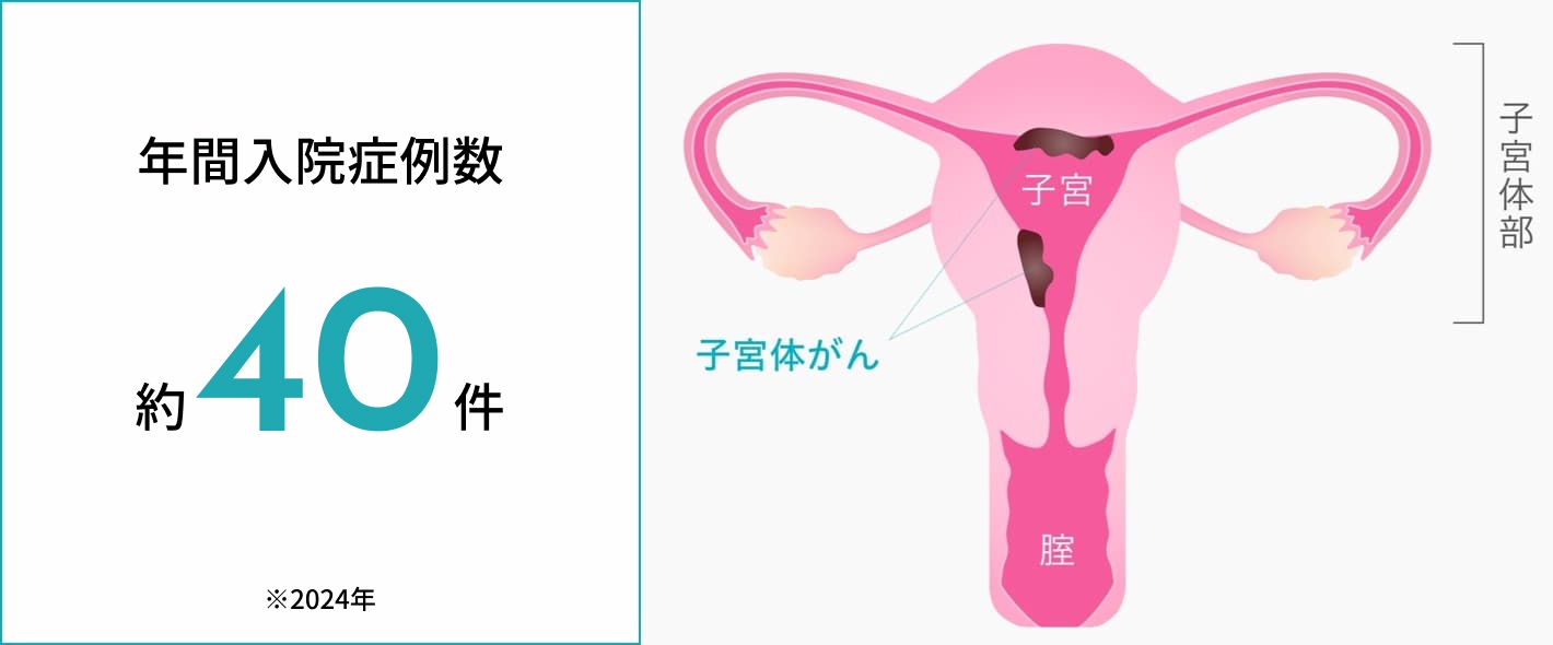 子宮内膜症の電気手術はどのように行われるのですか?