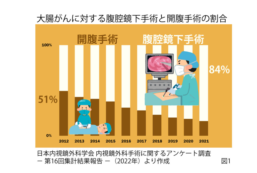 大腸がんに対する腹腔鏡下手術の実際