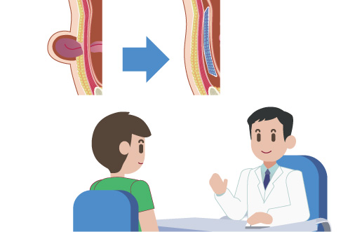 腹壁瘢痕ヘルニアって治療が必要？