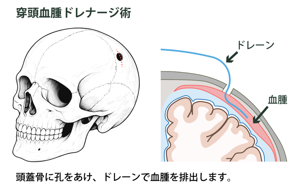 体への負担が少ない治療