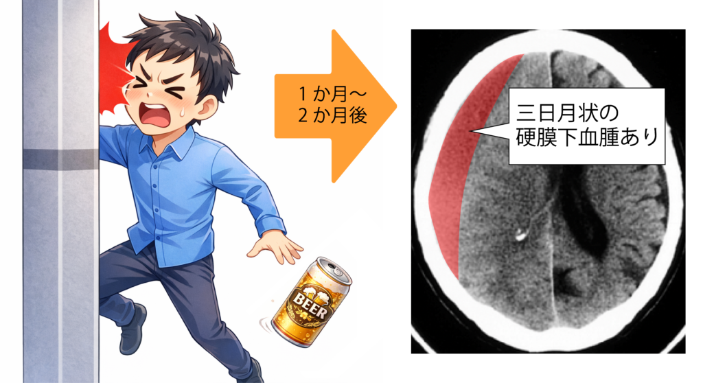 慢性硬膜下血腫という病気